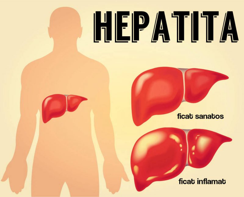 28 iulie: Să eliminăm hepatita!