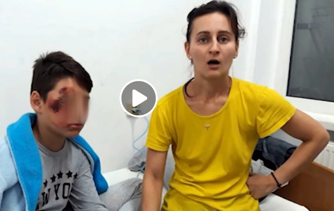 Elev desfigurat în curtea școlii!