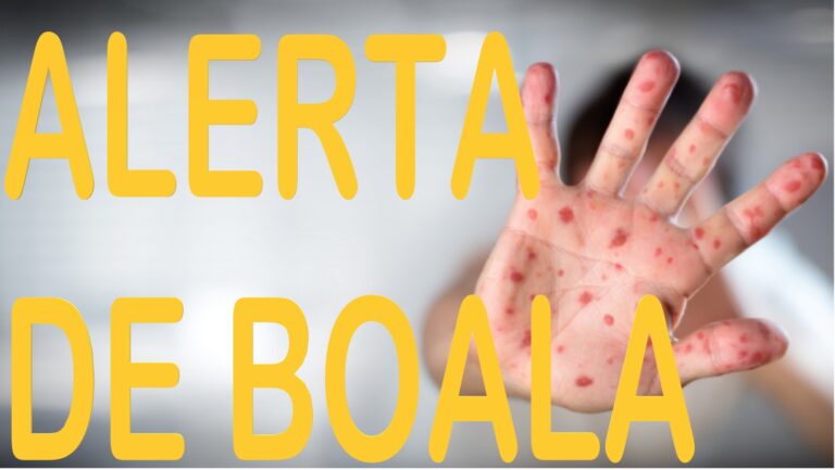 Colcăie virusul rujeolic în Câmpulung Muscel. Numărul bolnavilor crește alarmant